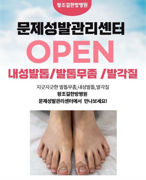팝업